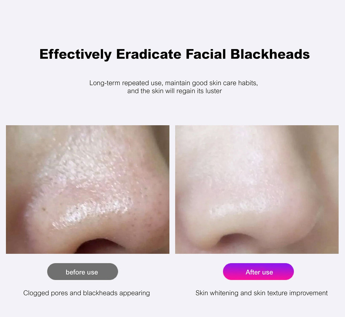 Blackhead Remover Pore Vacuum - fabufabu design store